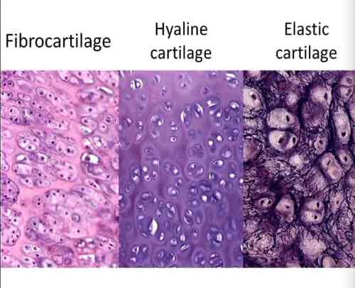 <p>cartilage (connective tissue)</p>