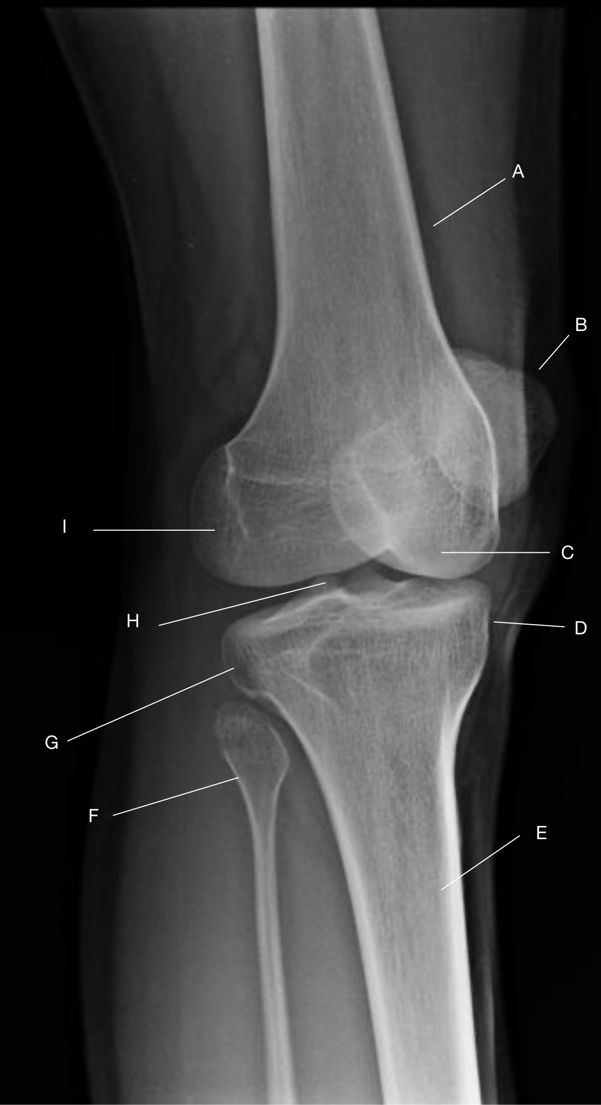 <p>Label the image.</p>