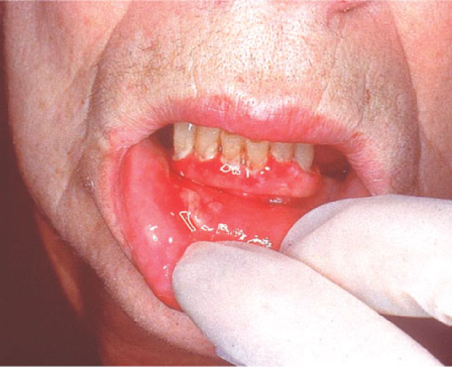 knowt flashcard image