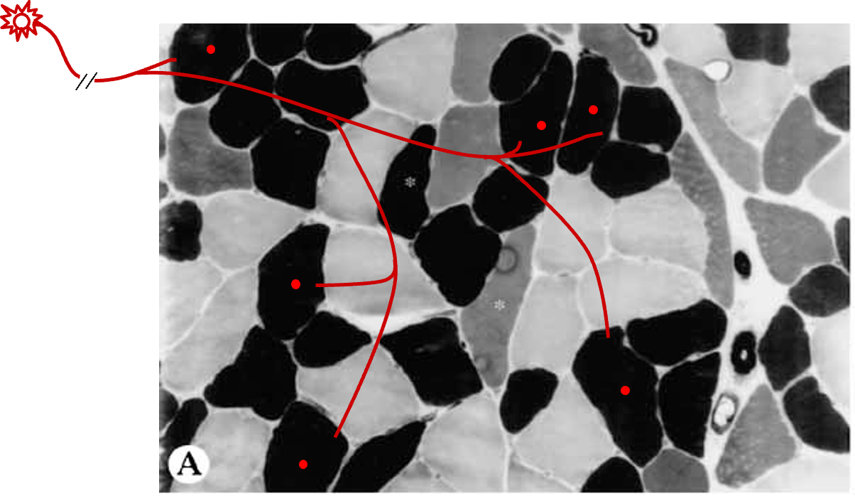 <ul><li><p>The myofibers of each motor unit are ______ in the muscle</p></li><li><p>All myofibers of one unit are of the _____ fiber-type</p></li></ul><p></p>