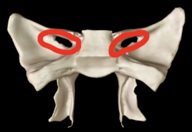 <p>What part of the sphenoid is this?</p>