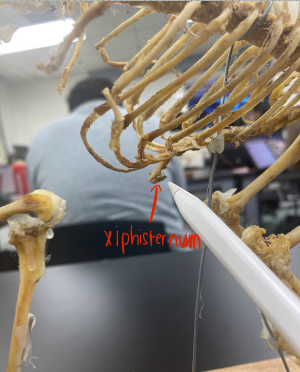 <p>Xiphisternum&nbsp;</p>