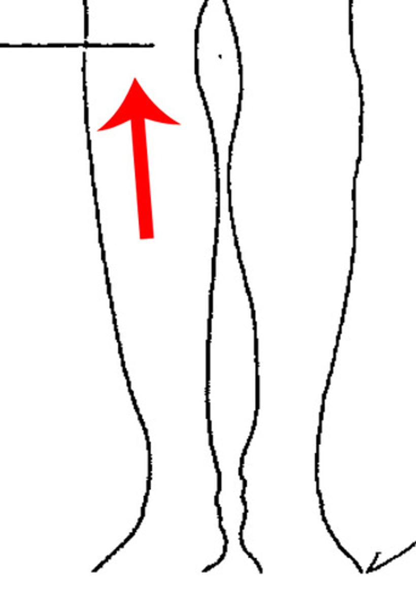 <p>Front of knee.</p>