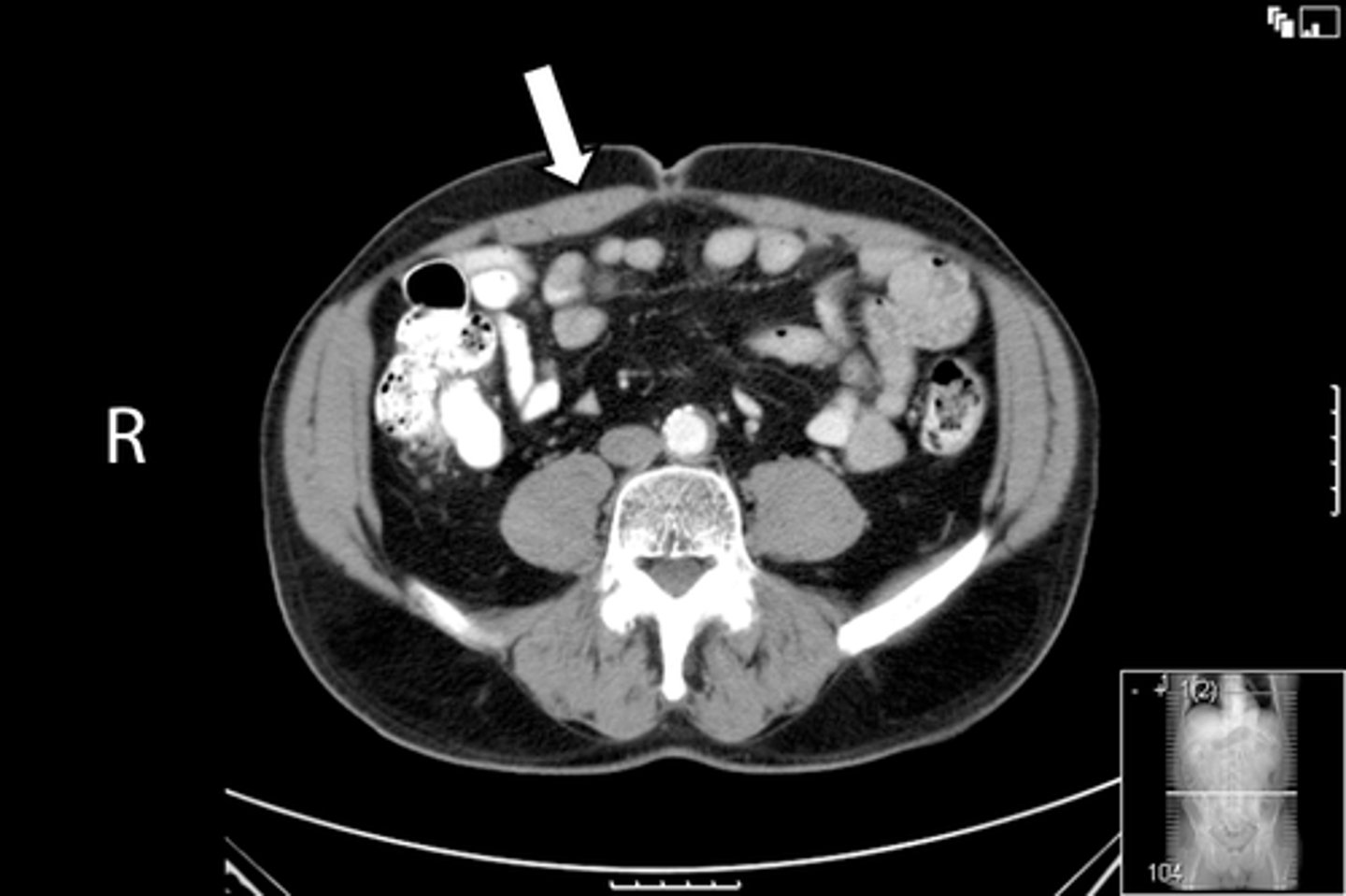 <p>What is indicated in the image?</p>