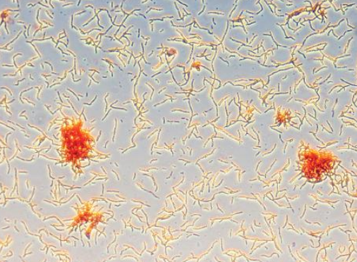 Intestinal bacteria. (© Richard C. Li.)