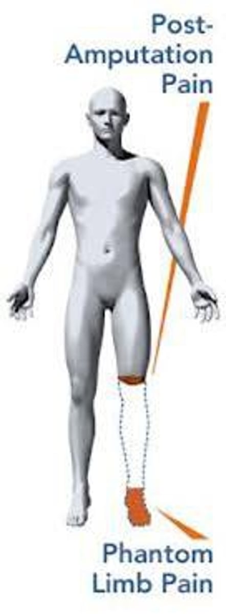 <p>same perceptions aren't based entirely on current sensory information, so we need to "fill in the gaps"</p>