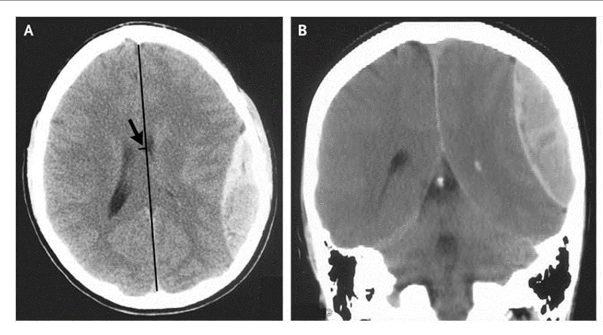 <p>What is this pathology?</p>