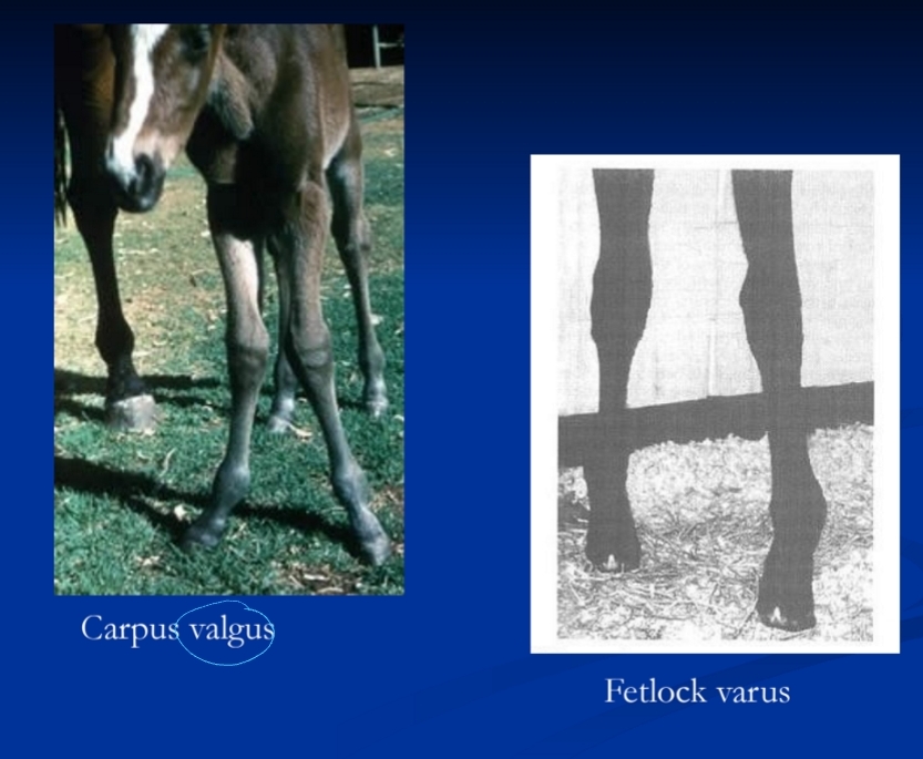 <p><span style="background-color: transparent;"><strong><span>Angular Limb Deformities</span></strong></span></p>