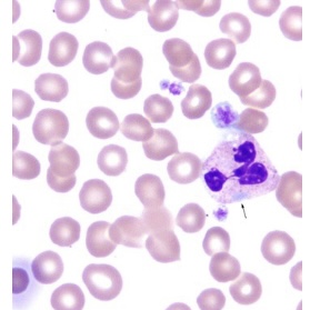 <p><span style="font-family: Helvetica; font-size: 12px;">Inclusions in the cytoplasm of neutrophils as shown in this picture are known as:</span></p>