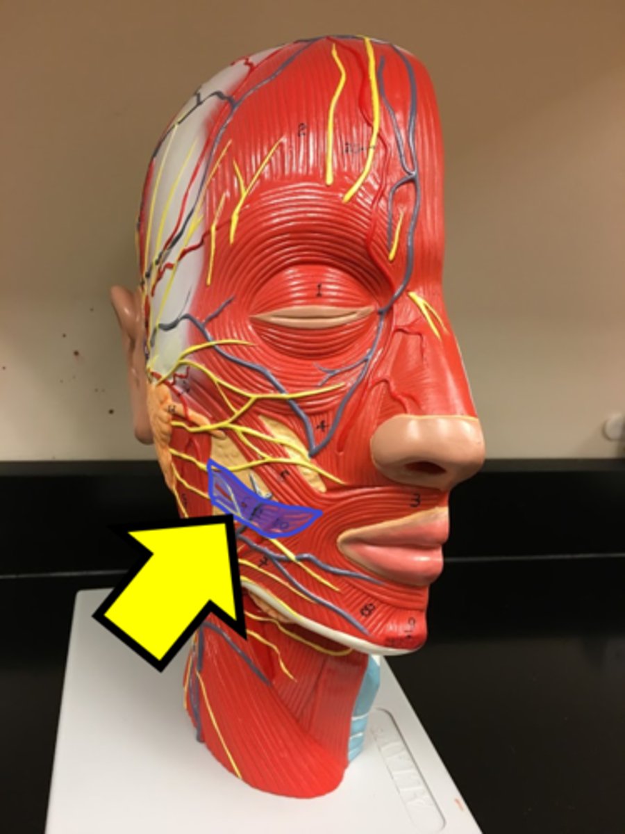 <p>Name the muscle</p>