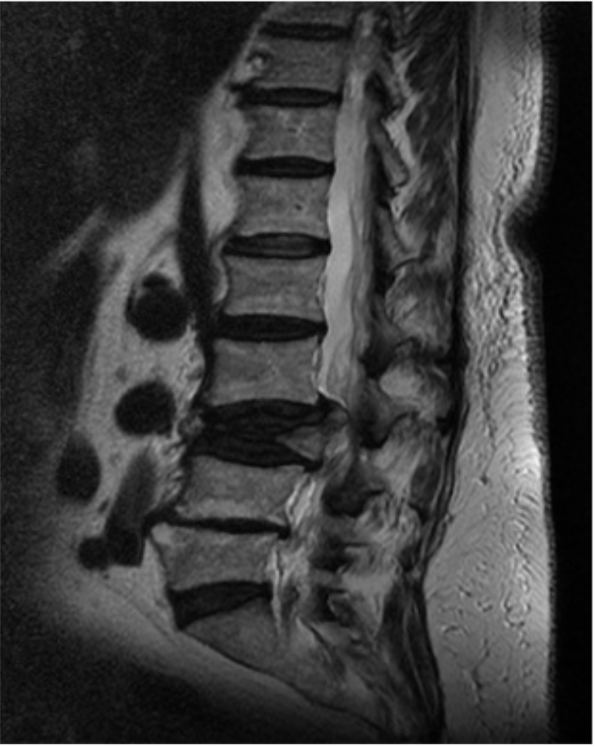 <p>What weighting is this image? What structures appear hypointense in these sequences?</p>