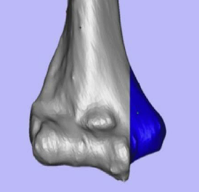 <p>what is this called: small rounded bump where muscles, tendons, ligaments attach to the bone</p>
