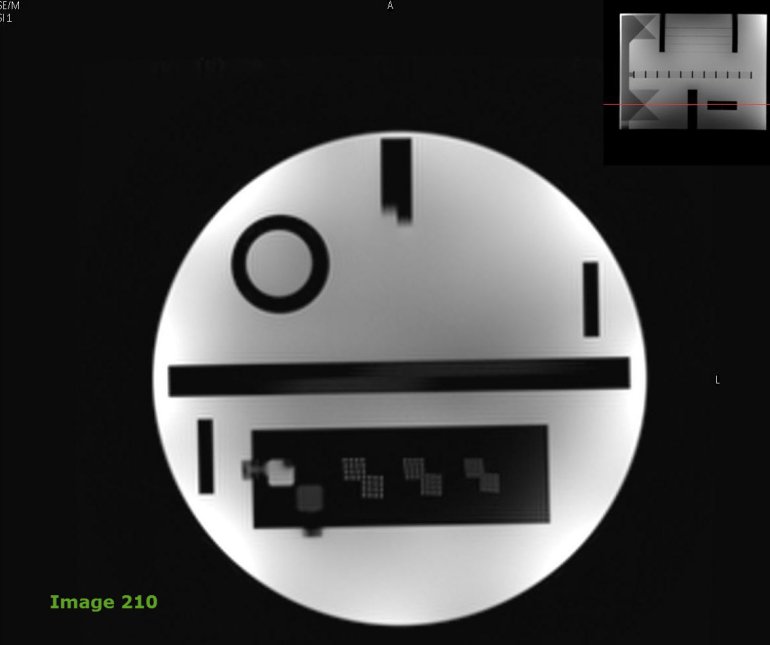 <p><strong>In acquiring ACR QA data, Image 210 is used to evaluate for what quality measure?</strong></p>