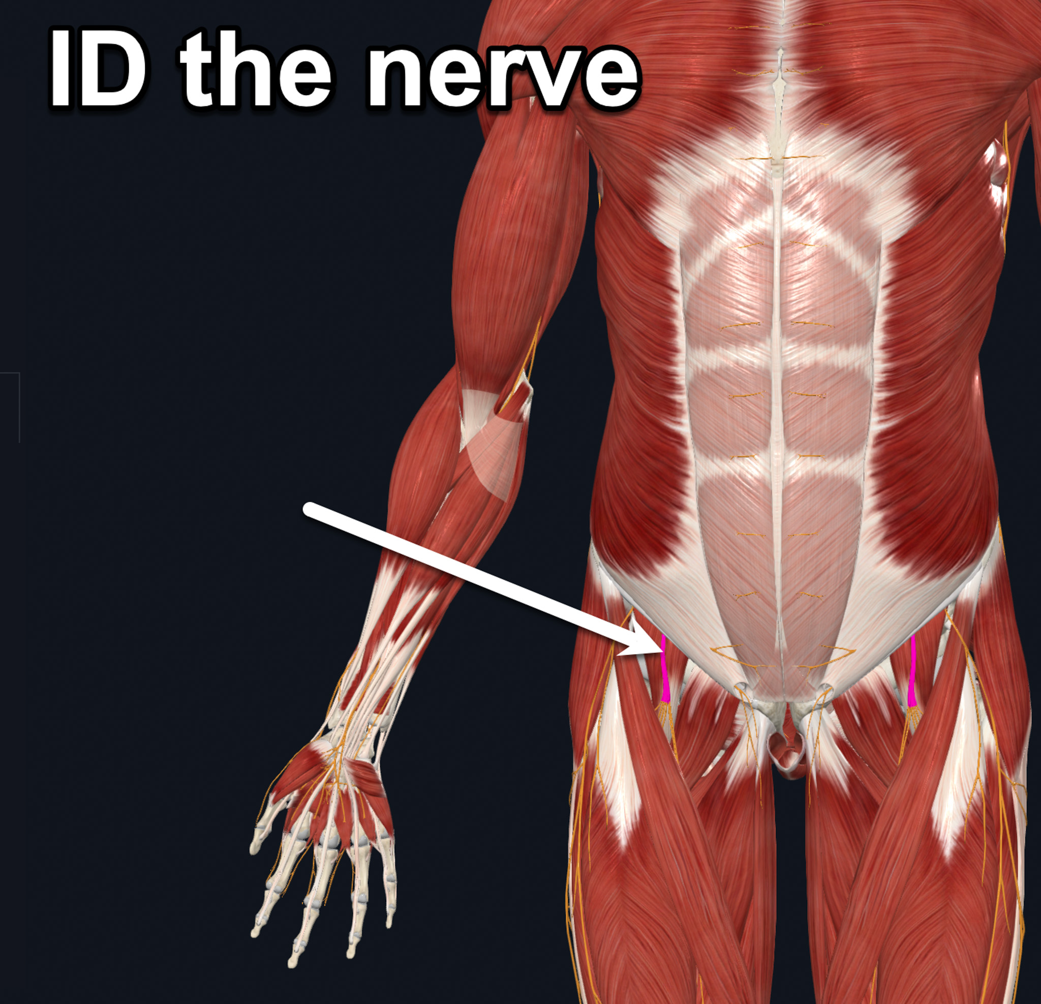 term image