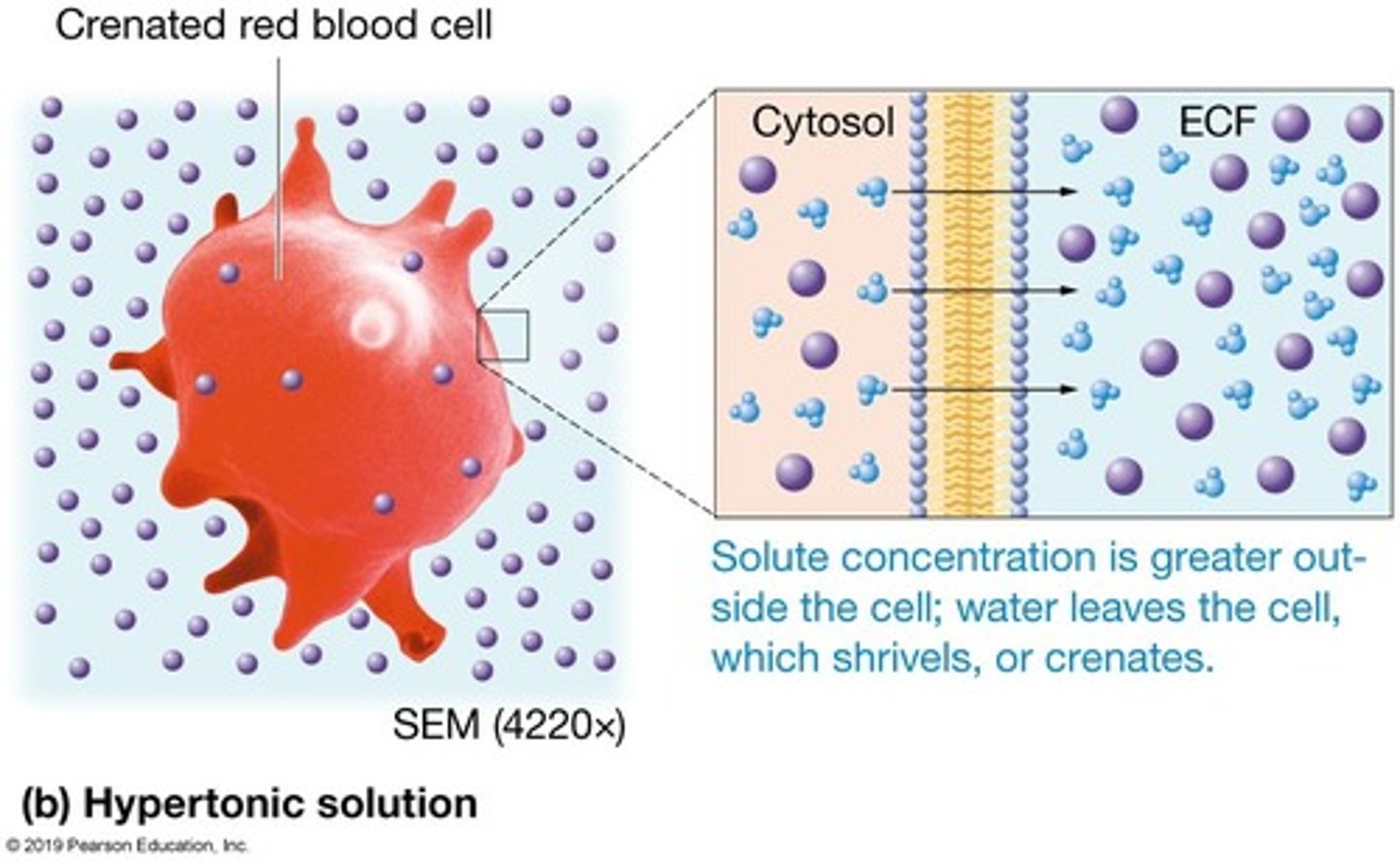 <p>Greater concentration of non-penetrating solutes than the cell. </p><p>Crenates the cell (cell loses water and shrivels).</p>