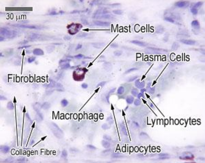 <p>• Fixed Vs Migratory Cells</p><p>• <strong>Fibroblasts</strong>&nbsp;- Least specialised cells, secrete the collagen and ground substance</p><p>• Adipocytes (fat cells)</p><p>• Immune cells</p><ul><li><p>Macrophages</p></li><li><p>Mast cells</p></li><li><p>Plasma cells</p></li></ul><p>• Other specialised cells (depend on the type of connective tissue) e.g.</p><ul><li><p>Osteocytes and osteoblasts (osteo = bone)</p></li><li><p>Chondrocytes and chondroblasts (chondro = cartilage)</p></li></ul><p></p><p>uno blood, bone, cartilage  are specialised forms of connective tissue</p><p></p>