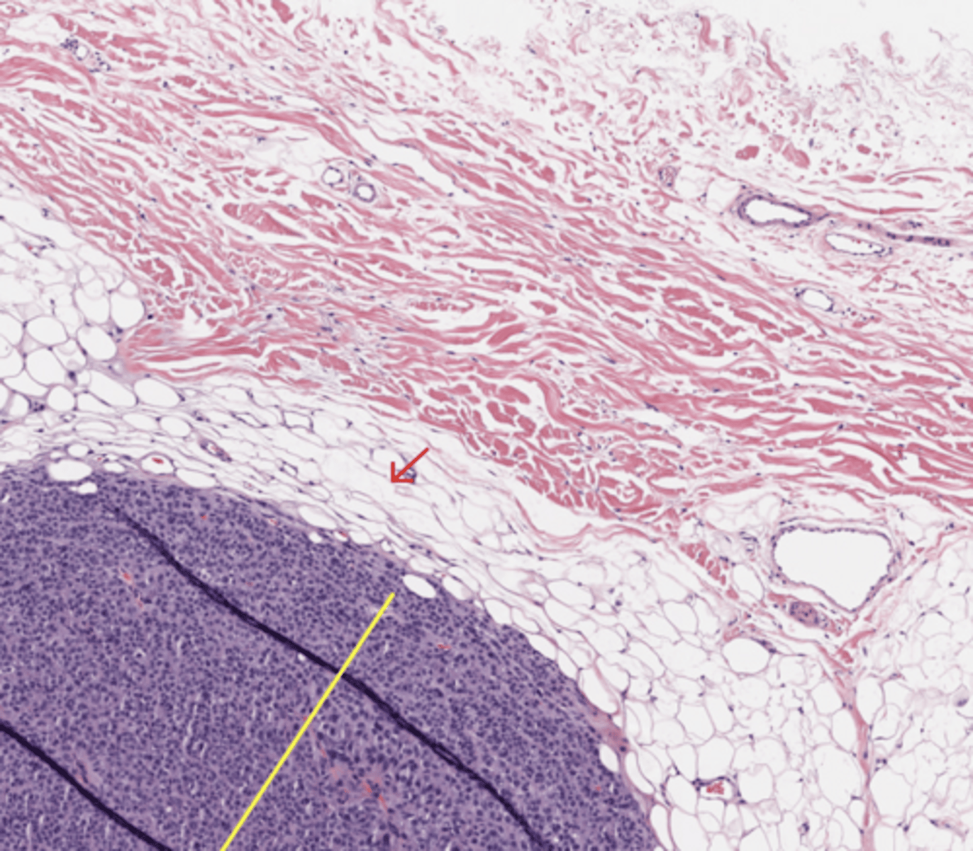 <p>Skin</p>