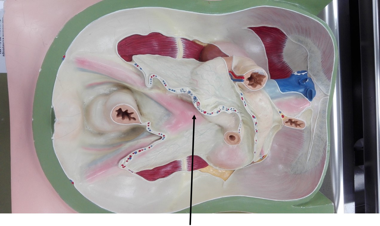 <p>structuur die “schemert” door peritoneum</p>