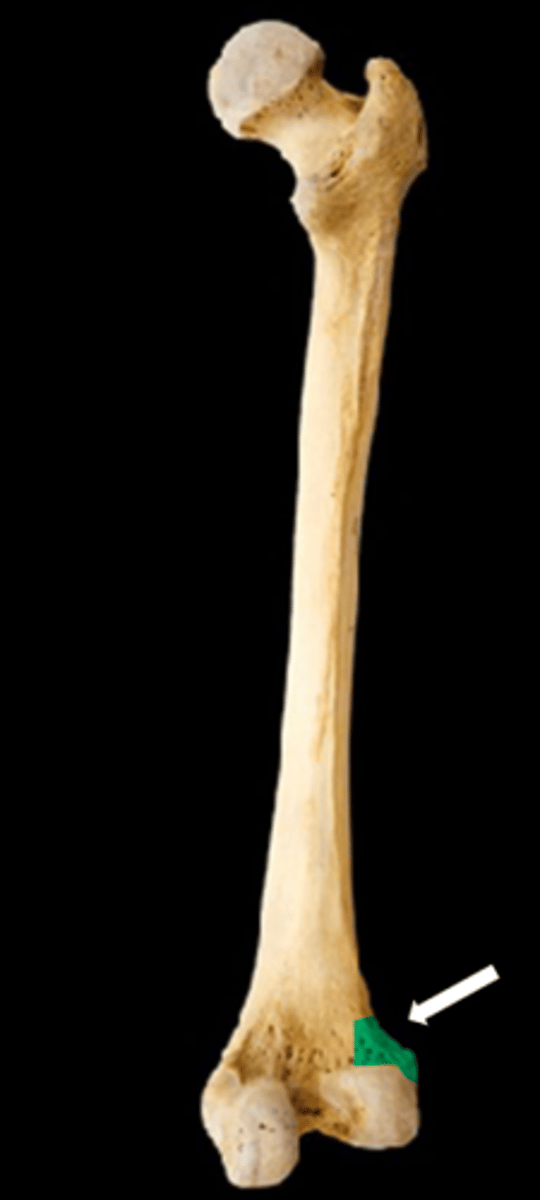 <p>name the part</p>