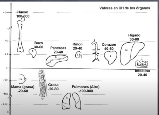 <p>En la tomografia y al ver la imagen podemos señalar los pixeles que nos interese medir para ver las unidades que tienen</p>