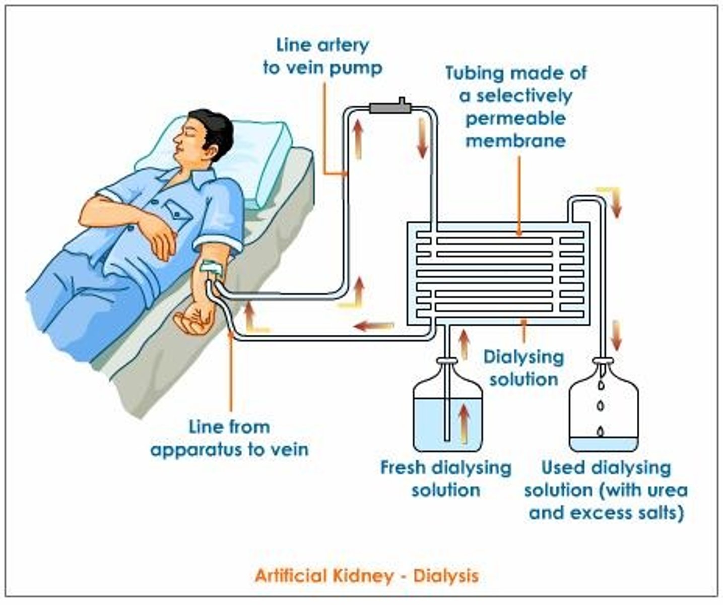 <p>(dy-AL-uh-sis) The process of removing waste products from the blood by passing it through a membrane. (ការលាងតំរងនោម)</p>