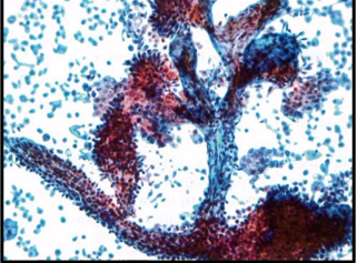 <p>LGUN features</p>