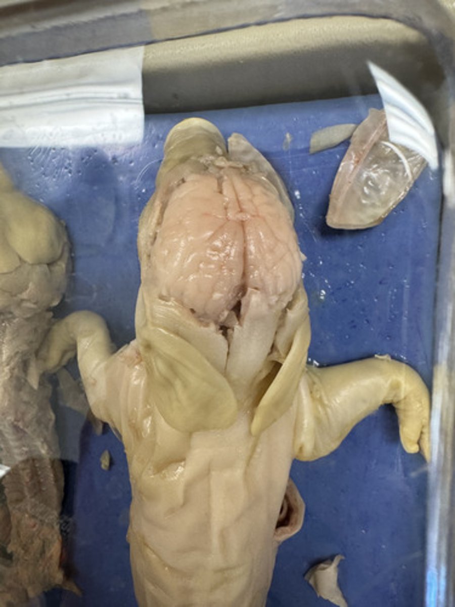 <p>What system does the Brain belong to?</p>