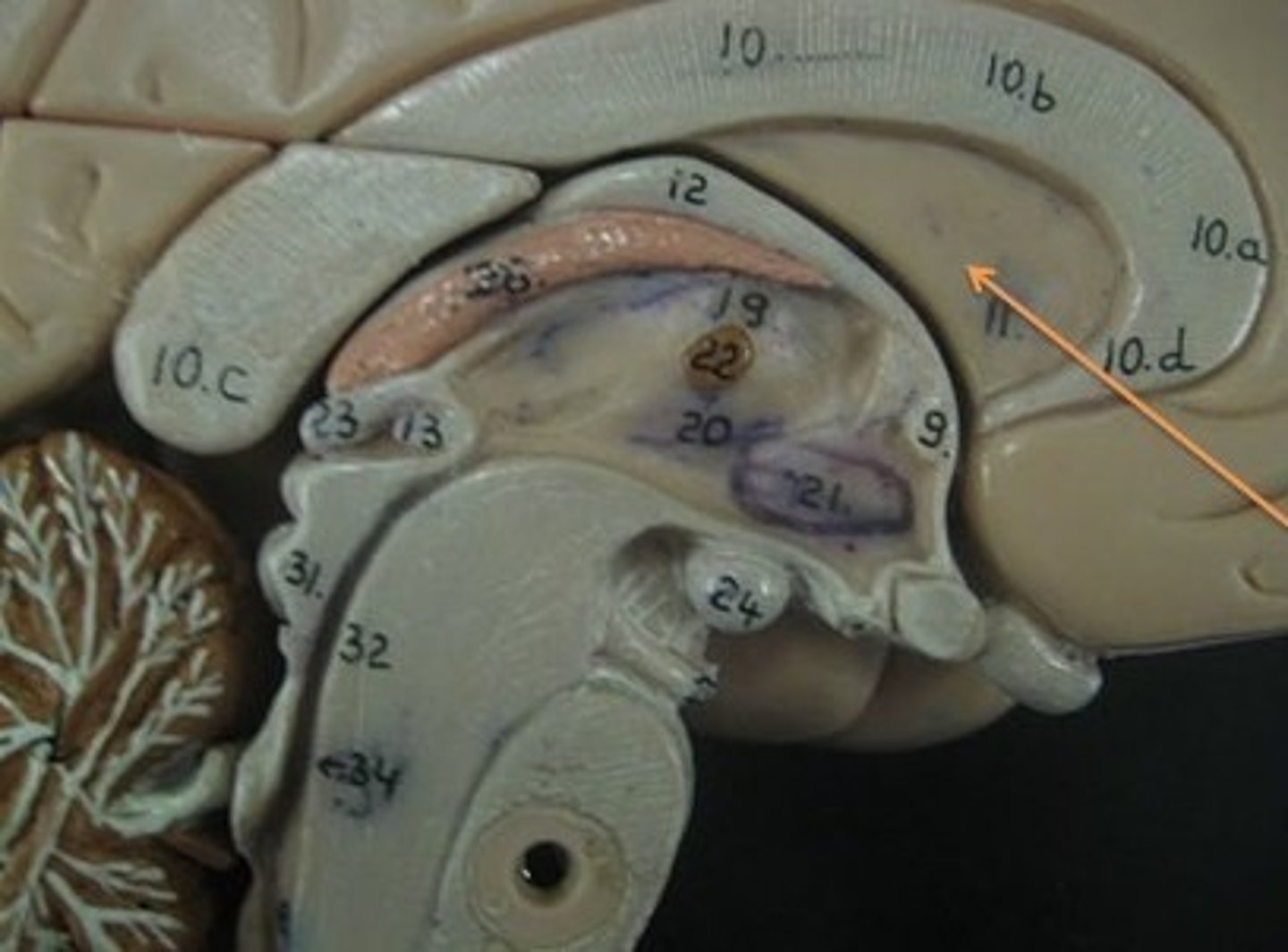 <p>Separates lateral ventricles</p>