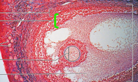 term image