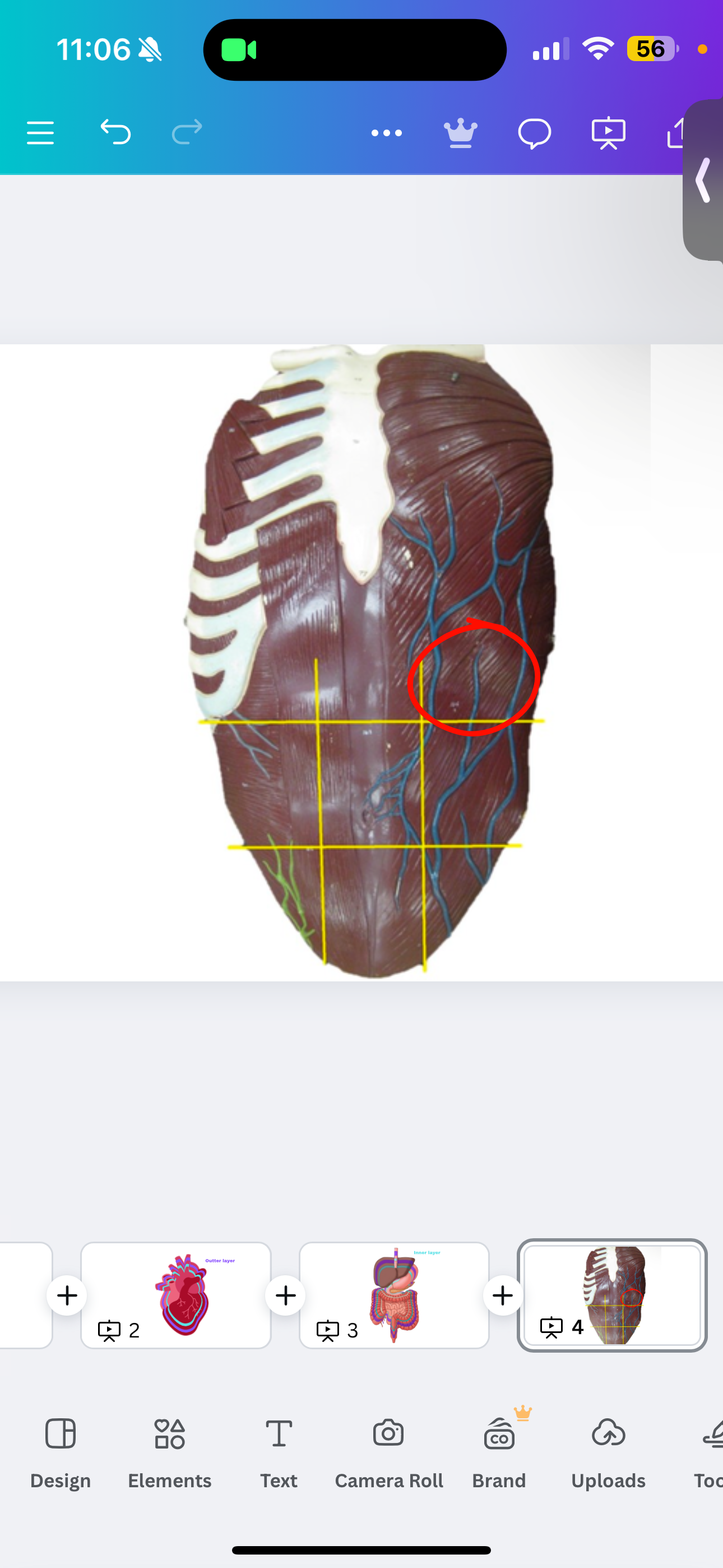 <p>Left hypochondriac region</p>