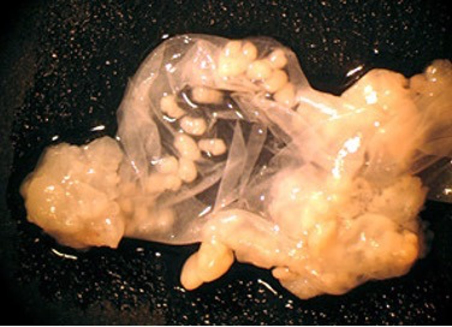 <p>Found in a ewe showing CNS signs such as head pressing. What parasite is this?</p>