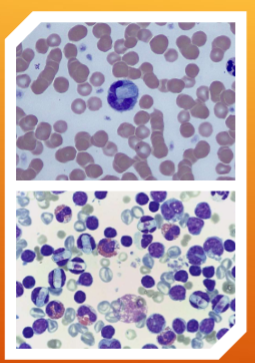 <p>What species does Hepatozoon spp.: H. canis and H. americanum&nbsp;infect </p>