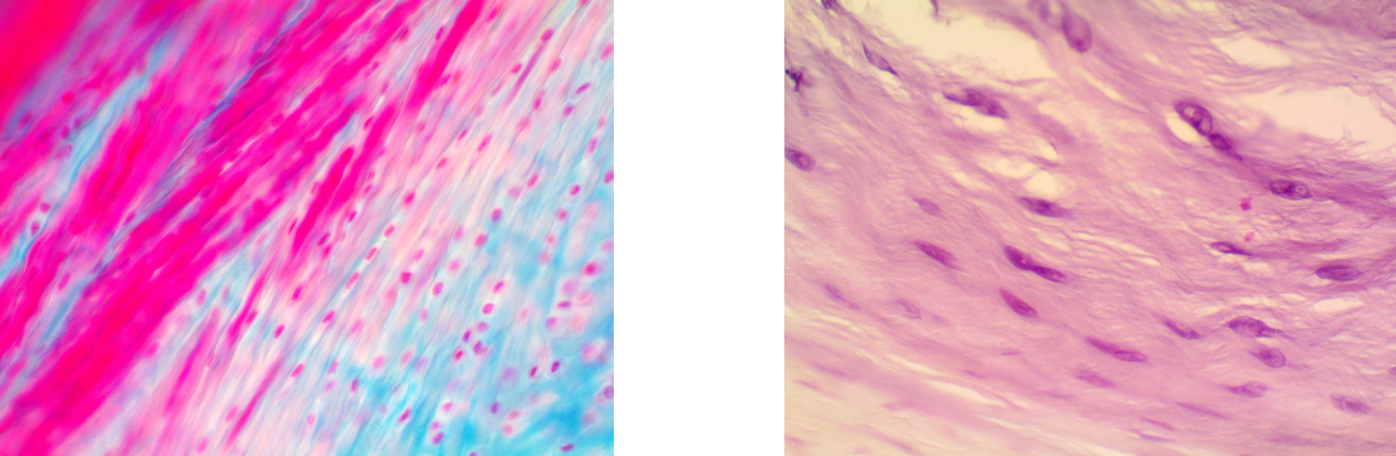 <p>Fibrocartilage connective tissue</p>