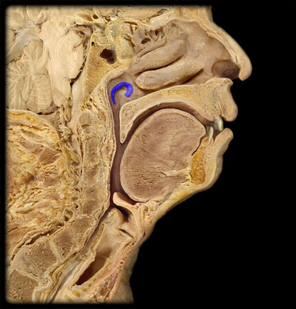 <p>ridge surrounding the Eustachian tube</p><ul><li><p>ridge </p></li></ul><p></p>