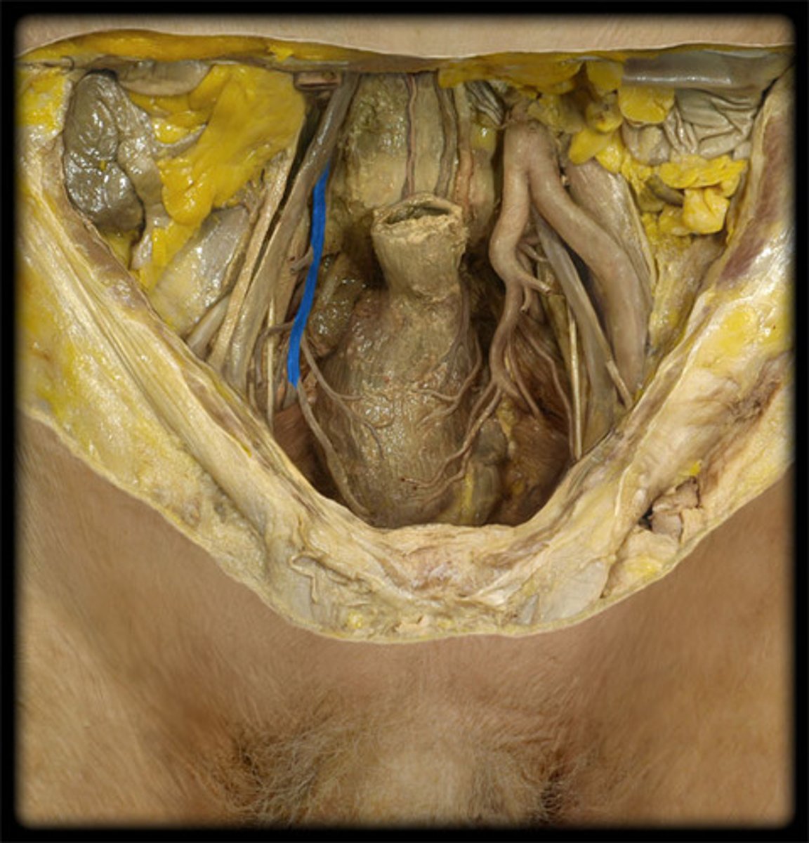 <p>-more medial than external iliac artery</p><p>-inferior to artery</p>