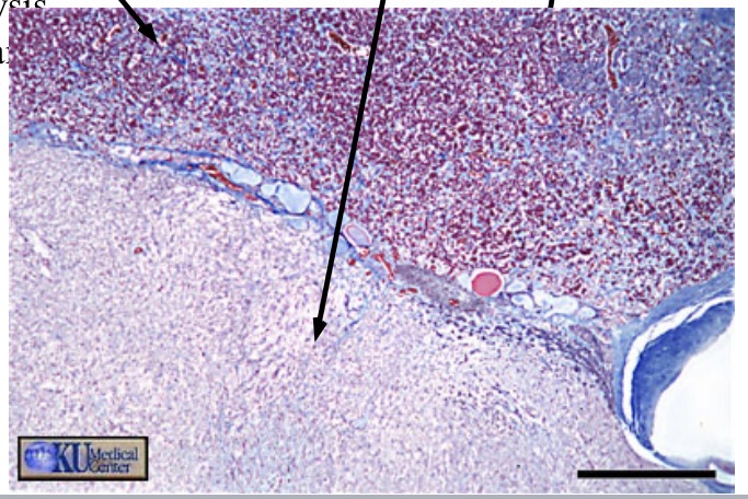 <p>Neurohypophysis</p>