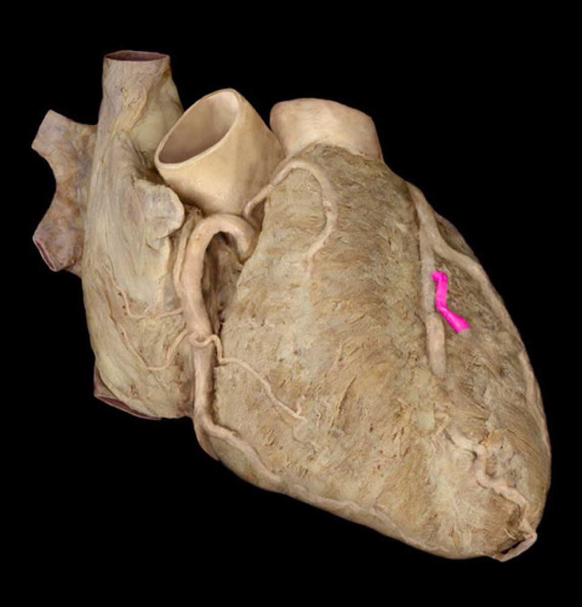 <p>left coronary artery branch</p>