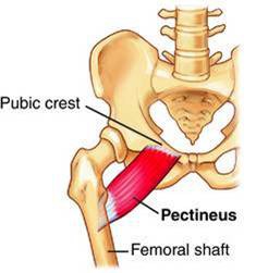 <p>Proximal Medial femur to linea tendon</p>