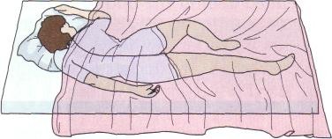 Left side-lying position. The upper leg is sharply flexed so it is not on the lower leg. The lower arm is behind the person