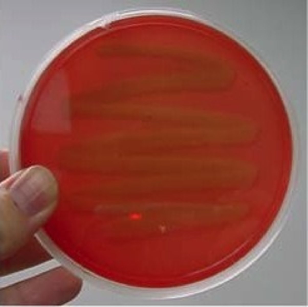 <p>no breakdown of hemoglobin</p>