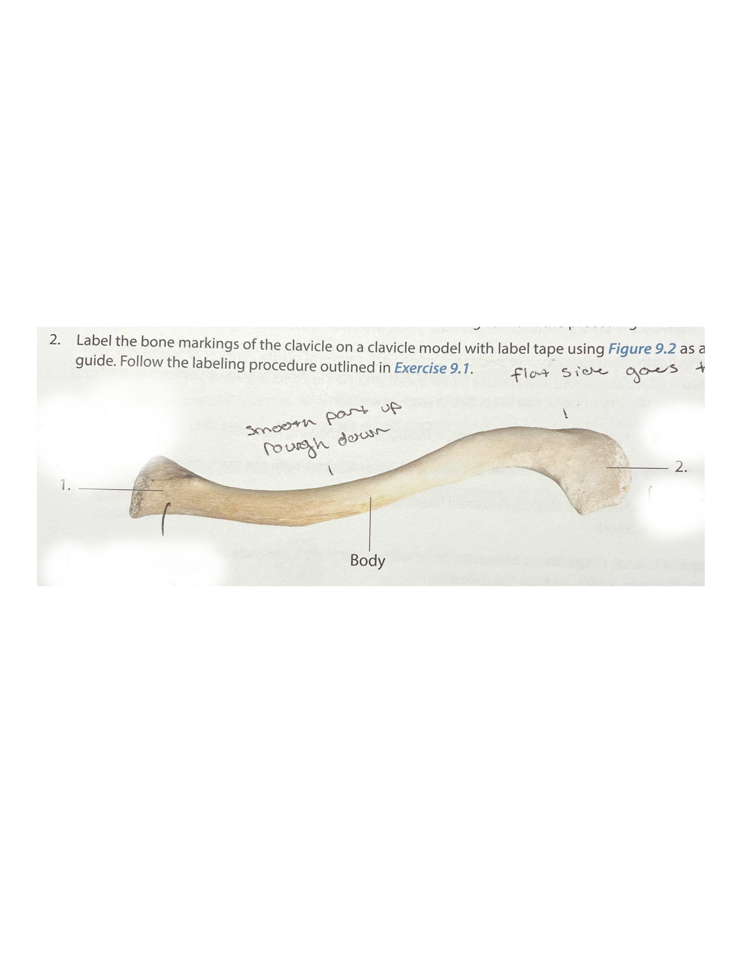 <p>What bone is this?</p>
