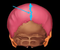 <p>interlocking line of union between bones</p>
