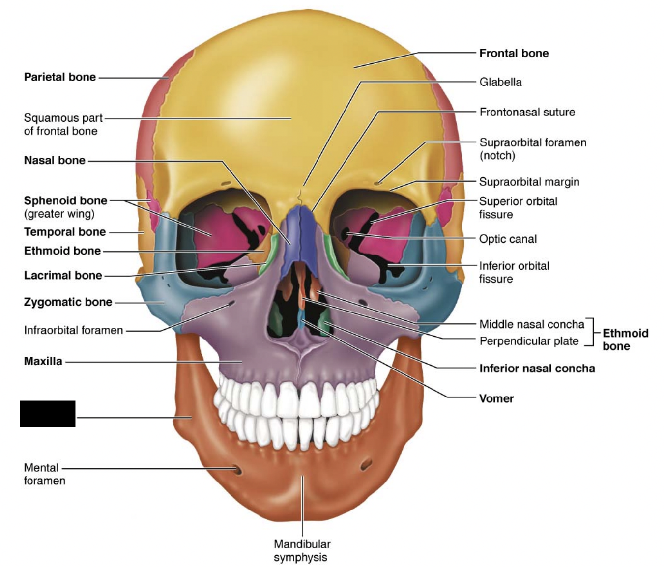What facial bones is this?