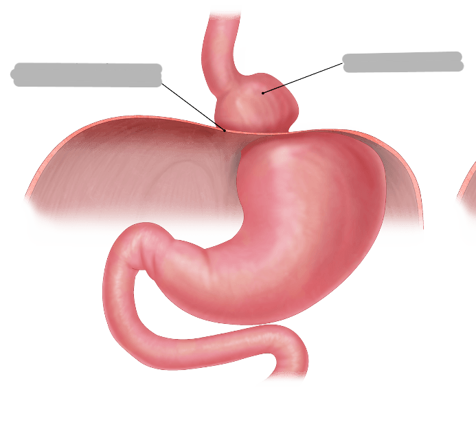 <p>What pathology is shown here?</p>