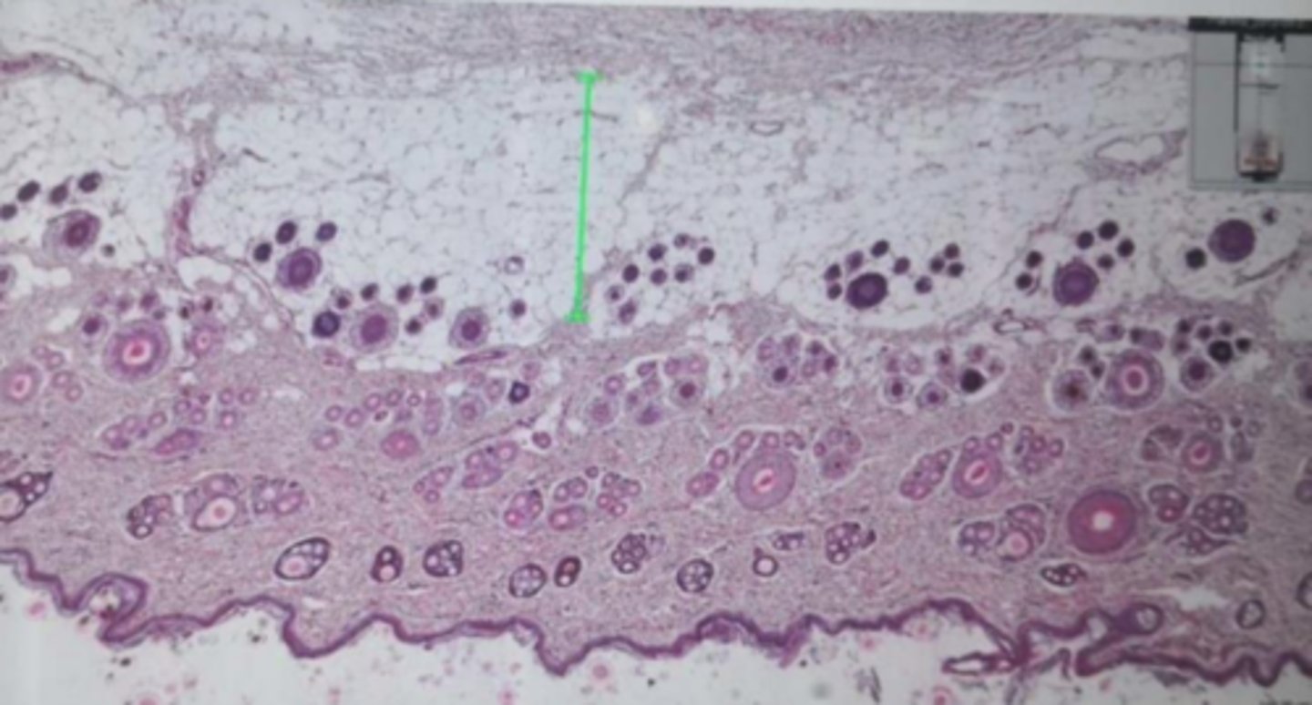 <p>Which layer is marked in green in this skin section?</p><p>a) Epidermis</p><p>b) Dermis</p><p>c) None, it is thin skin</p><p>d) Hypodermis</p>
