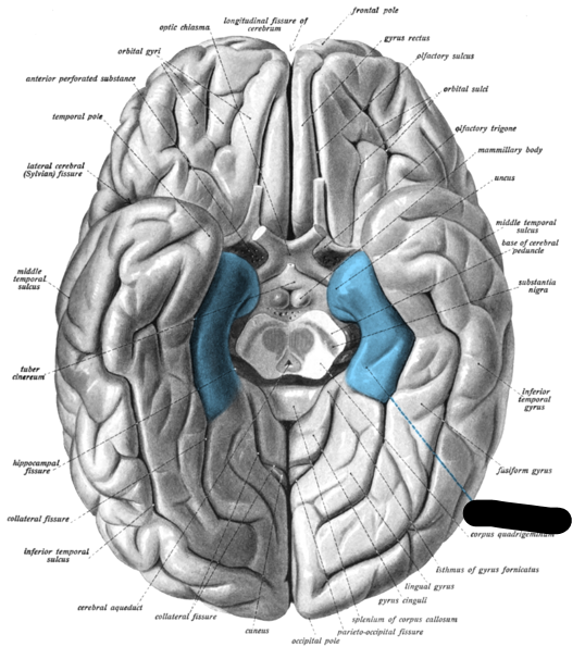 <p>What is the blue part?</p>