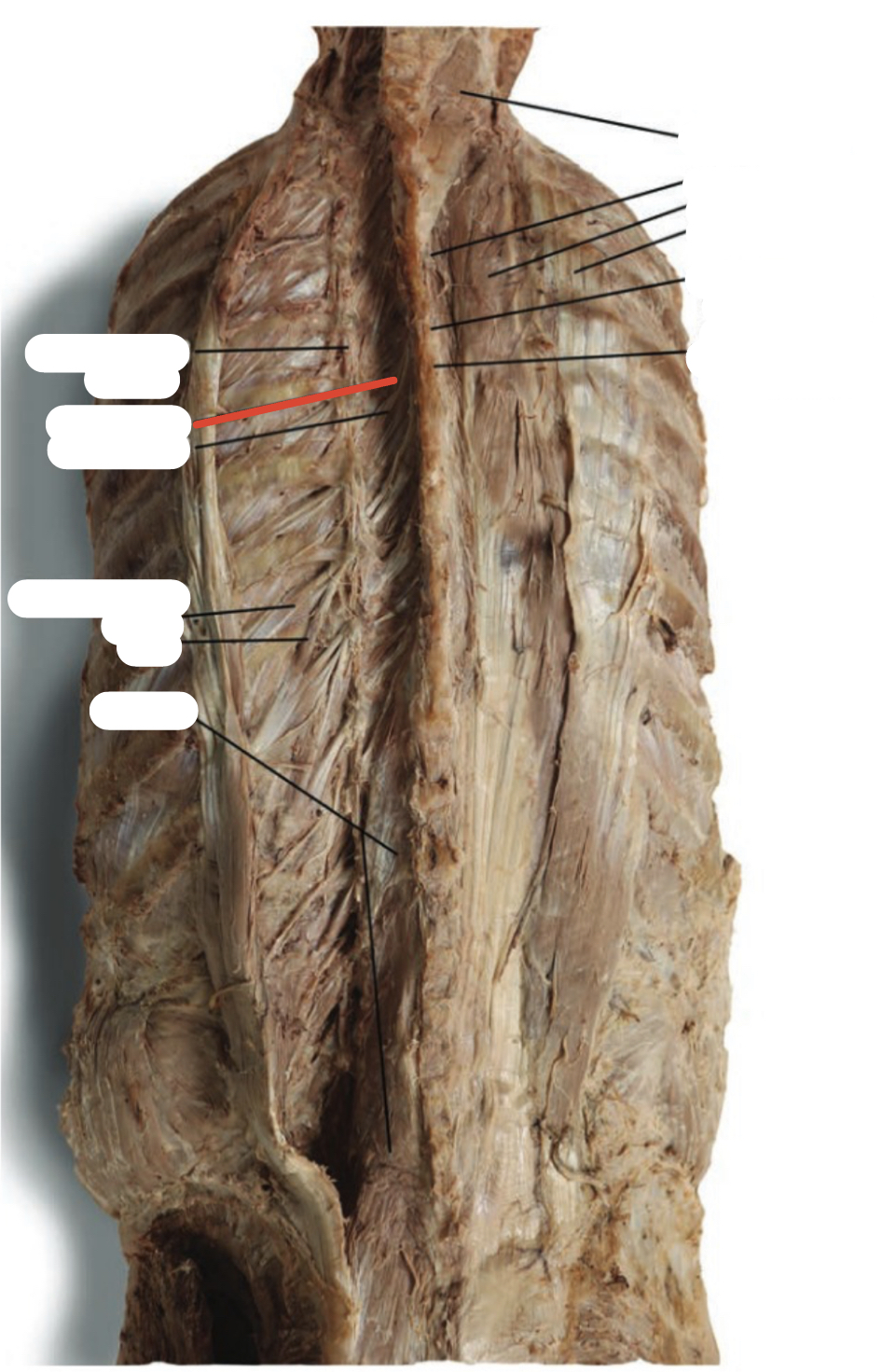 Identify the structure (red line)