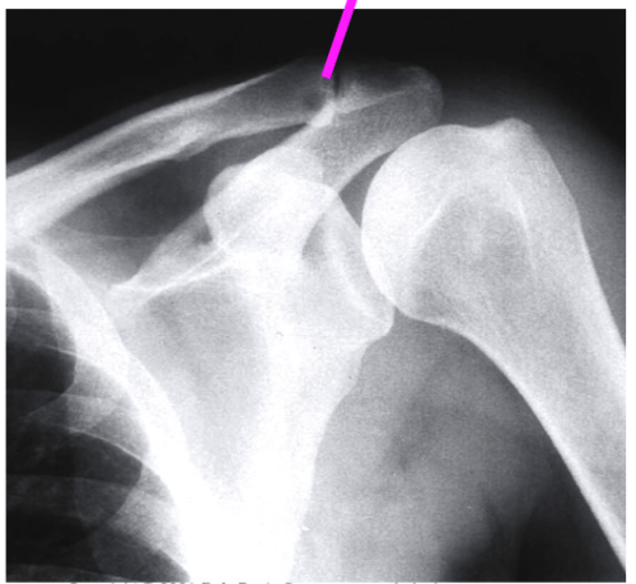 <p>what does the pink line point to?</p>