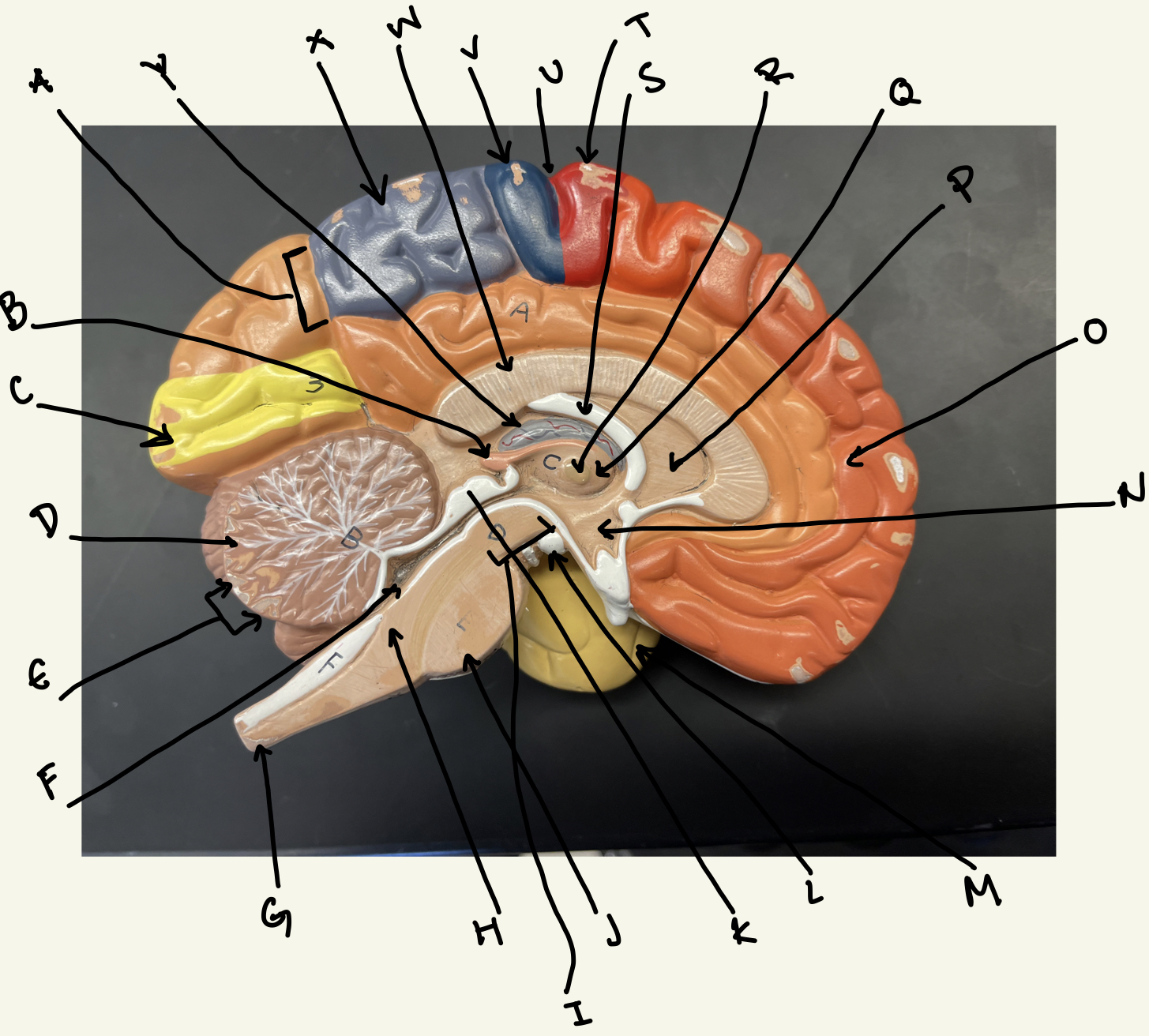What is the top portion of the corpora quadrigemina?