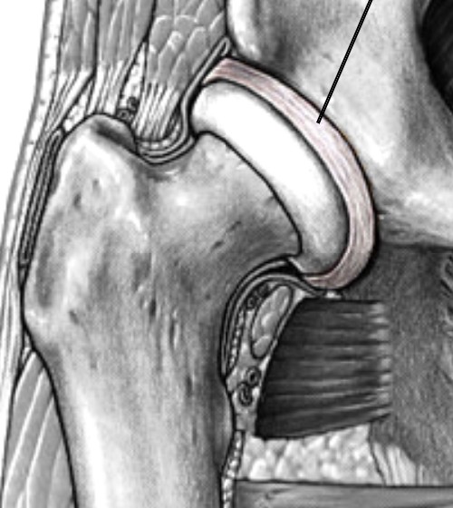 <p>Which part of the hip is the edge of hip socket?</p>